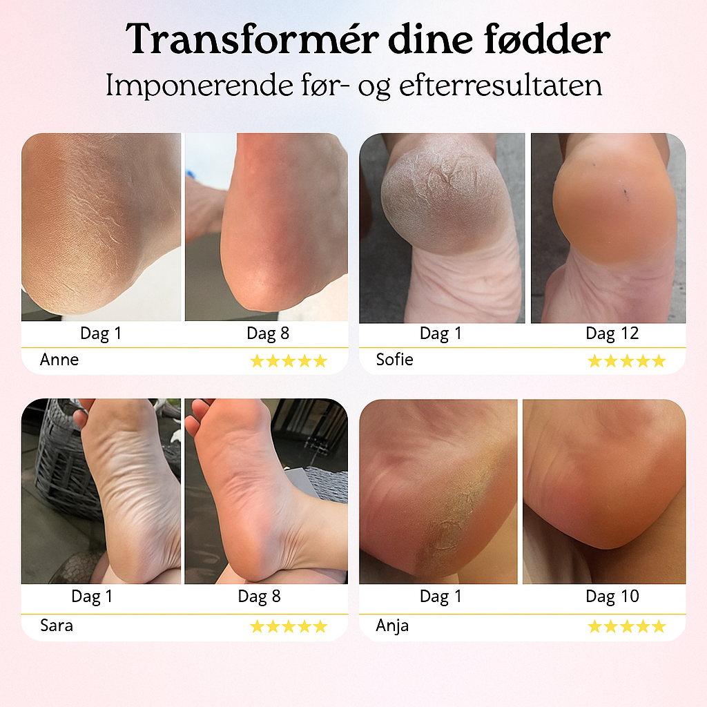 SilkeFod™ Pro 2.0 | Løsningen til babybløde fødder